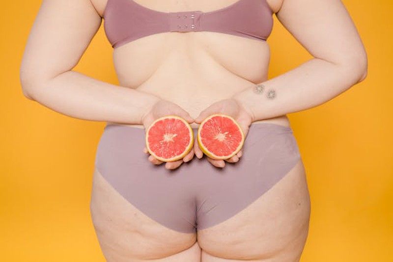 ¿Cómo reducir la celulitis?