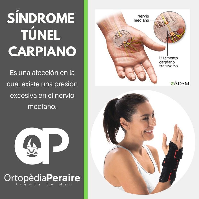 ¿Cuáles son síntomas y tratamiento del síndrome del túnel carpiano?