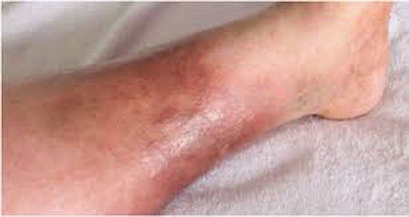 ¿Cómo funciona corpitol?