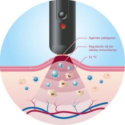 Herpotherm Bolígrafo contra el herpes