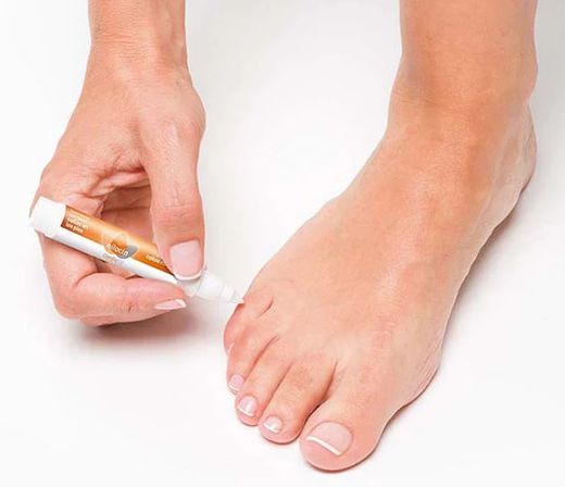 Llapis Tractament 3 en 1 per a eliminació de tripes als peus