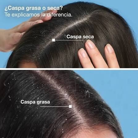 Rene Furterer Neopur champú para caspa seca 150mL