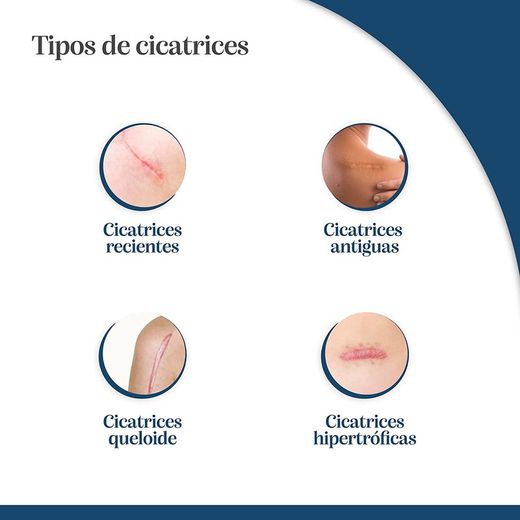 Trofolastin Reductor de cicatrius 5 apòsits de 5x7.5cm